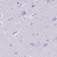 HPA IHC Cerebral cortex — HSPB1