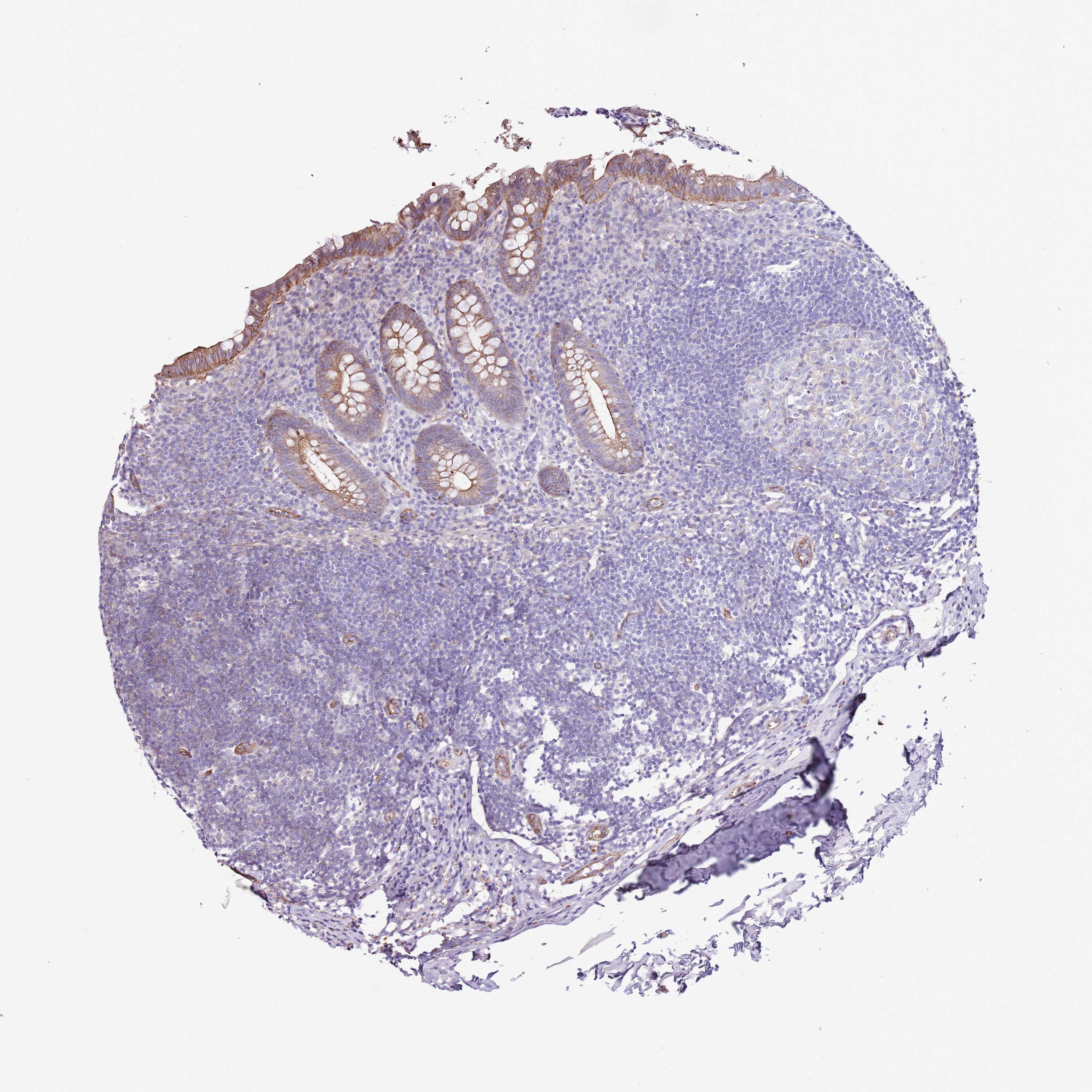 Tissue expression of GFRAL Staining in appendix The Human Protein Atlas