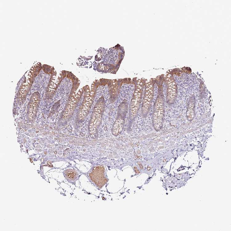Tissue expression of GFRAL Staining in appendix The Human Protein Atlas