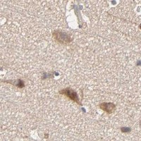 HPA IHC Cerebral cortex — ARHGEF7