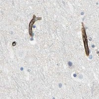HPA IHC Cerebral cortex — FLNB