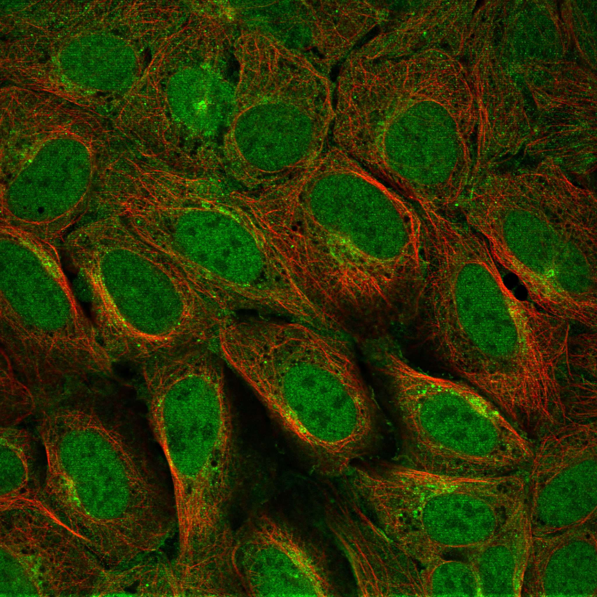 Subcellular TMEM176B The Human Protein Atlas