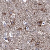 HPA IHC Cerebral cortex — SHOC2