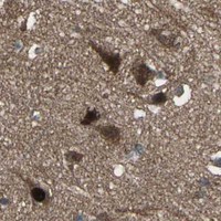 HPA IHC Cerebral cortex — COPS5