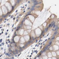 HPA IHC Colon — HGS