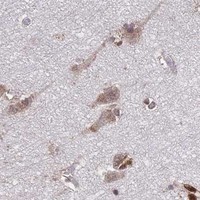 HPA IHC Cerebral cortex — HDGF