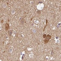 HPA IHC Cerebral cortex — CEP78