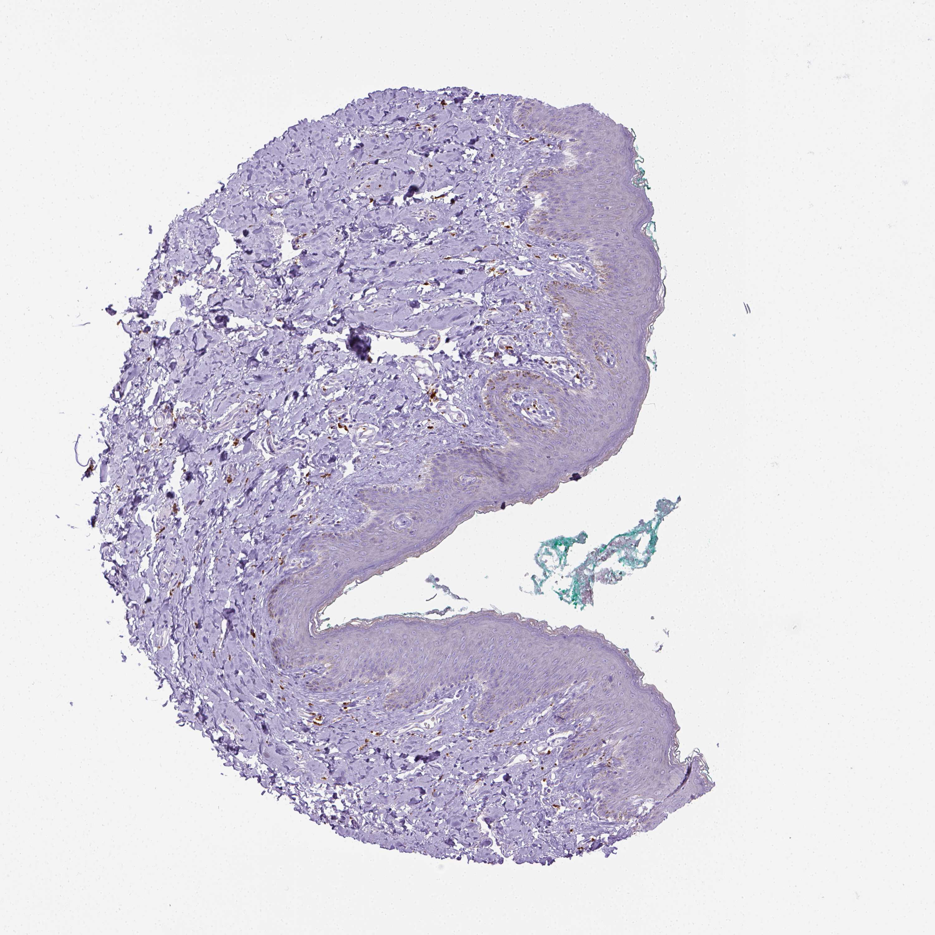 Tissue expression of CD68 Staining in skin The Human Protein Atlas