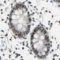 HPA IHC Colon — CBX3