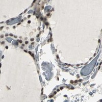 HPA IHC Thyroid gland — CBX3