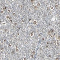 HPA IHC Cerebral cortex — CBX3