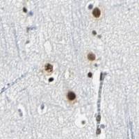 HPA IHC Cerebral cortex — HNRNPD