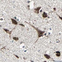 HPA IHC Cerebral cortex — AATF