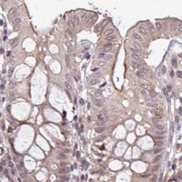 HPA IHC Colon — NOB1