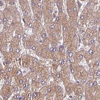 HPA IHC Liver — NOB1