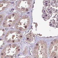 HPA IHC Kidney — NOB1