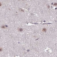 HPA IHC Cerebral cortex — NOB1