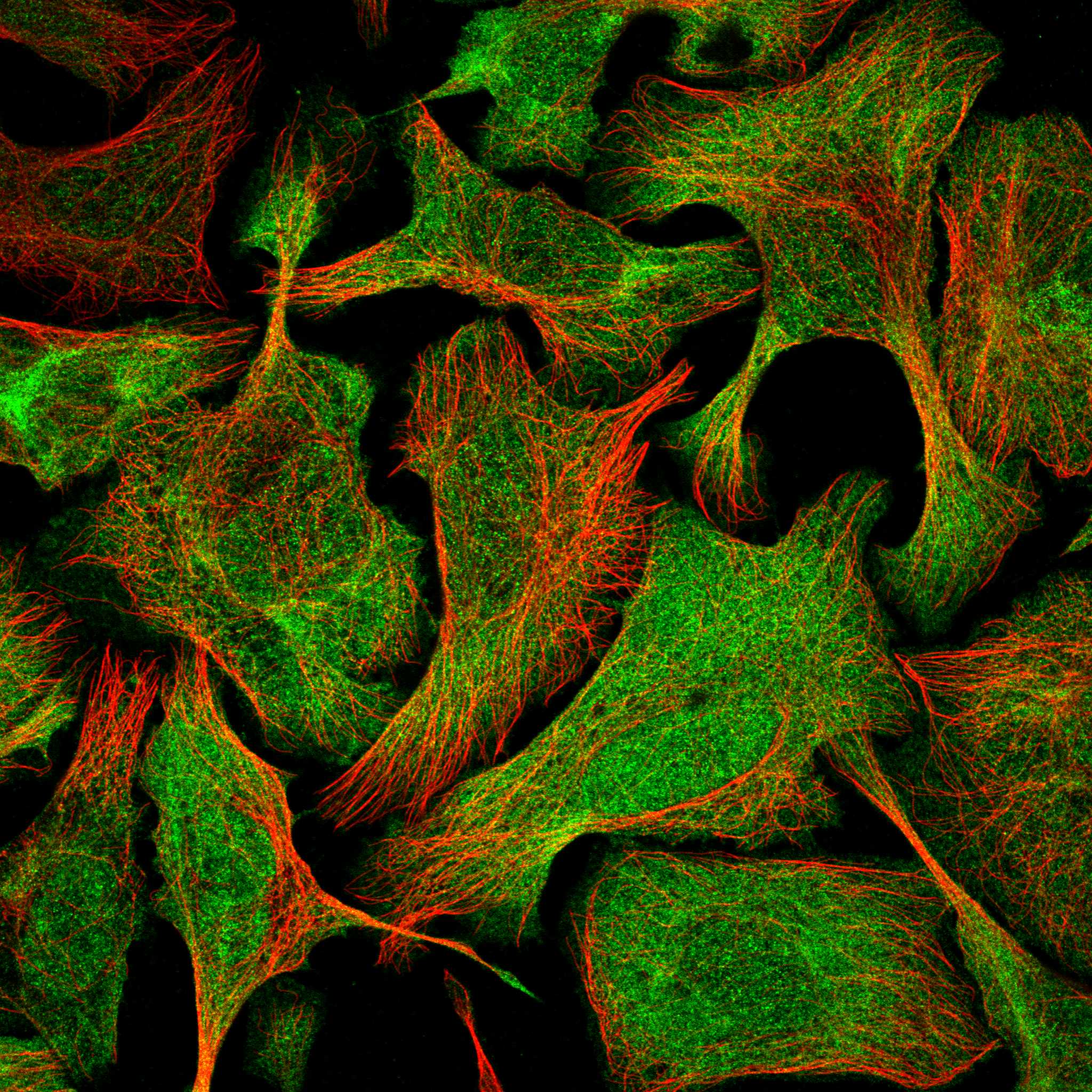 Subcellular SRSF2 The Human Protein Atlas