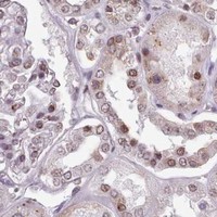 HPA IHC Kidney — SRRM1
