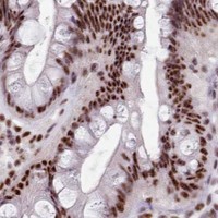 HPA IHC Colon — SRRM1