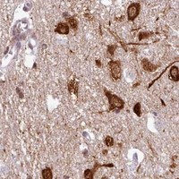HPA IHC Cerebral cortex — SRRM1