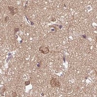 HPA IHC Cerebral cortex — TUSC3