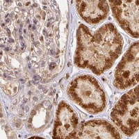 HPA IHC Kidney — RANBP9
