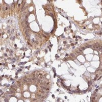 HPA IHC Colon — RANBP9