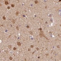 HPA IHC Cerebral cortex — RANBP9