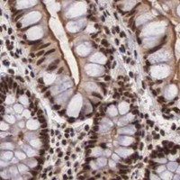 HPA IHC Colon — HTATSF1