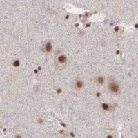 HPA IHC Cerebral cortex — HTATSF1