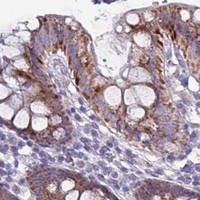HPA IHC Colon — HSD3B7