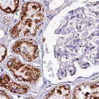 HPA IHC Kidney — HSD3B7