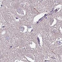 HPA IHC Cerebral cortex — HSD3B7