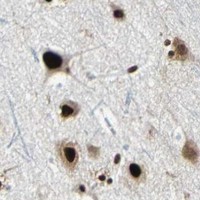 HPA IHC Cerebral cortex — HDAC2