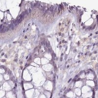 HPA IHC Colon — BDKRB2