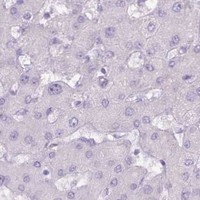 HPA IHC Liver — BDKRB2