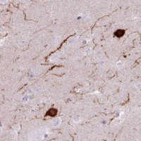 HPA IHC Caudate — BDKRB2