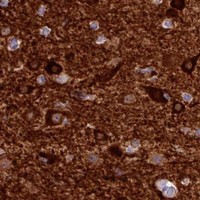 HPA IHC Cerebral cortex — BDKRB2