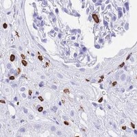 HPA IHC Kidney — CORO1A