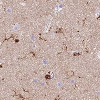HPA IHC Cerebral cortex — CORO1A