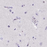 HPA IHC Cerebral cortex — ALDH3A1