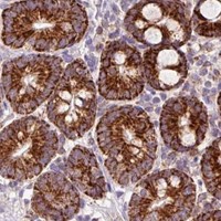 HPA IHC Small intestine — PCK2