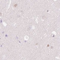 HPA IHC Cerebral cortex — PCK2