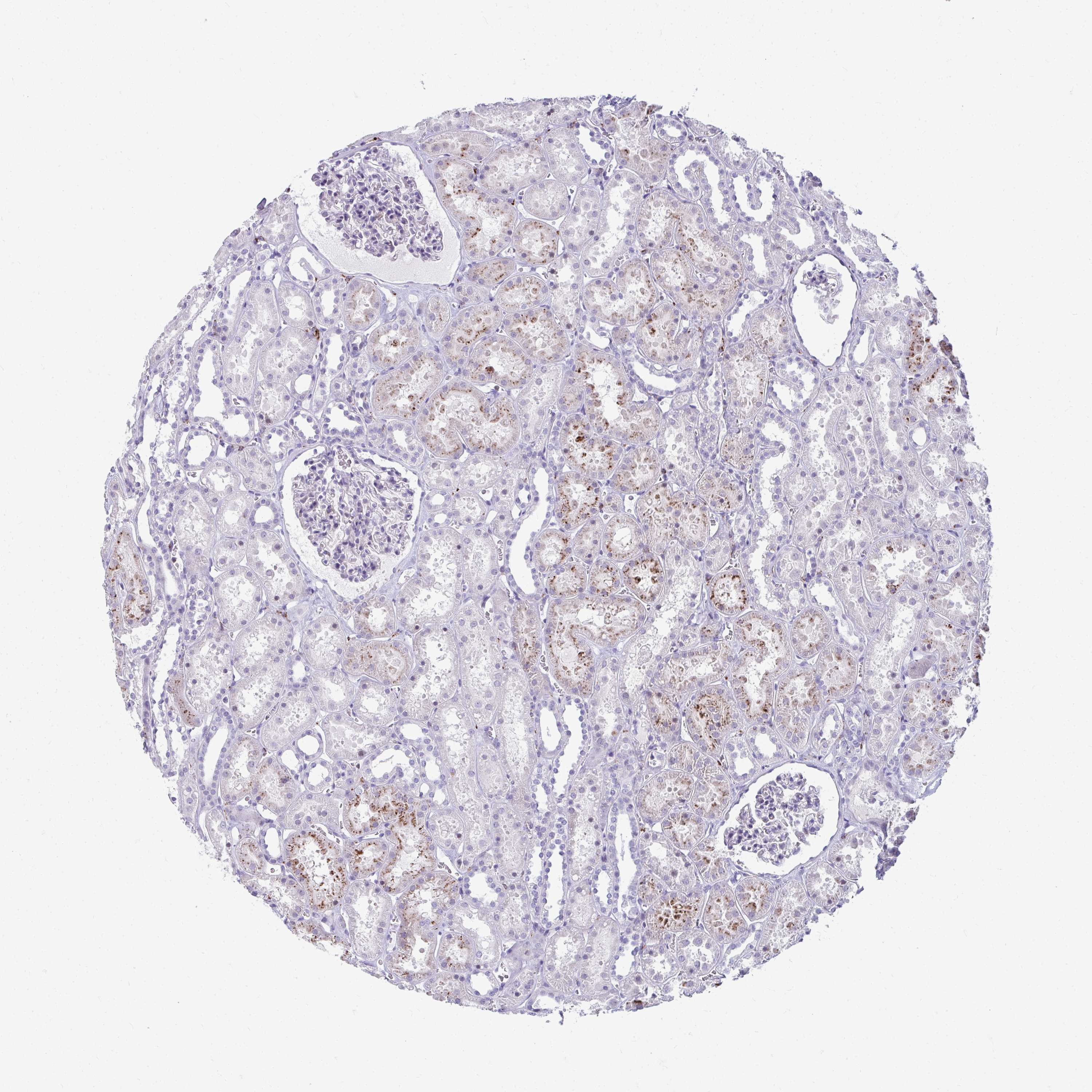 Tissue expression of CD163 Staining in kidney The Human Protein Atlas