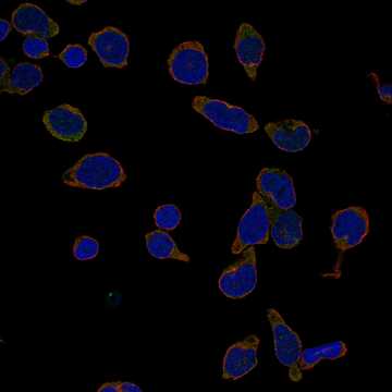 HPA052412: REH