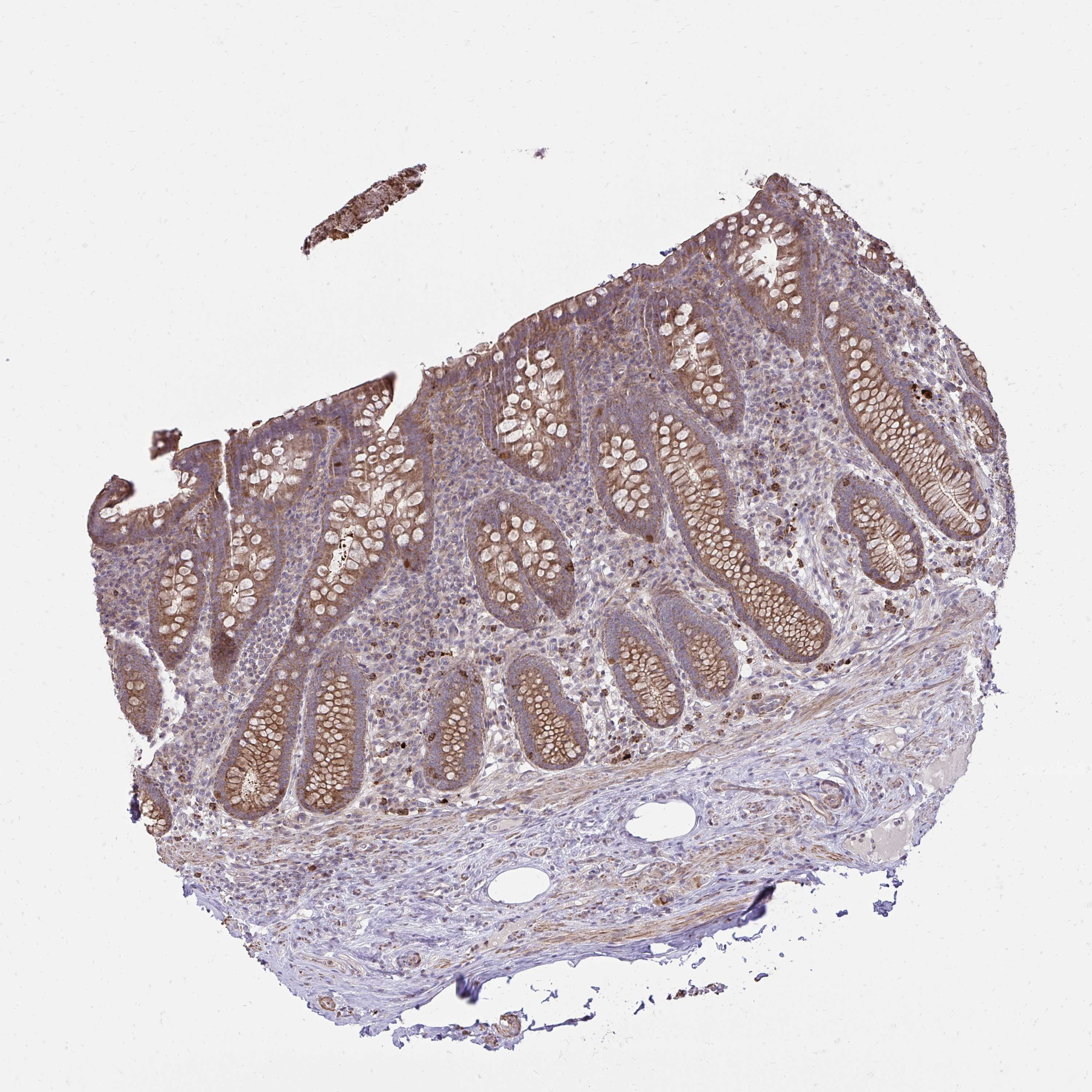 Tissue expression of SLC7A5 Staining in appendix The Human Protein
