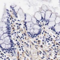 HPA IHC Colon — LAMB2