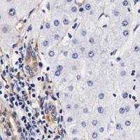HPA IHC Liver — LAMB2