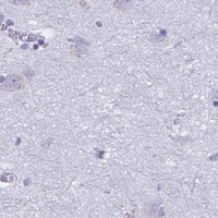HPA IHC Cerebral cortex — HMGB2